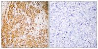 ZSCAN22 Polyclonal Antibody