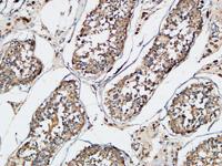 XIAP Polyclonal Antibody