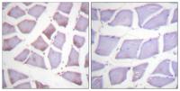 XIAP Polyclonal Antibody