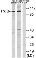 Trk B Polyclonal Antibody