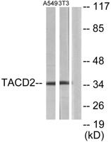 TROP-2 Polyclonal Antibody