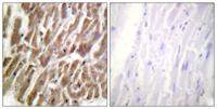 Troponin I-C Polyclonal Antibody