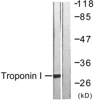 Troponin I-C Polyclonal Antibody