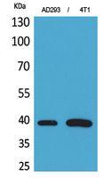 Troponin T-C Polyclonal Antibody