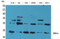 TRP14 Polyclonal Antibody