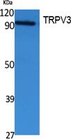 TRPV3 Polyclonal Antibody