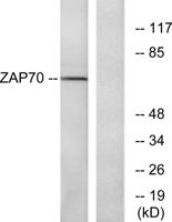 ZAP-70 Polyclonal Antibody