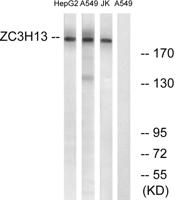 ZC3H13 Polyclonal Antibody