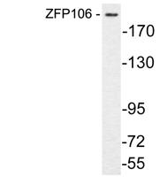 ZFP106 Polyclonal Antibody