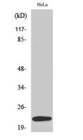 UBE2T Polyclonal Antibody