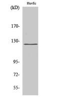 UBE3C Polyclonal Antibody