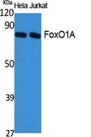 FoxO1A Polyclonal Antibody