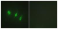 FoxO4 Polyclonal Antibody