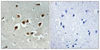 FoxO4 Polyclonal Antibody