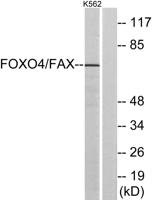 FoxO4 Polyclonal Antibody