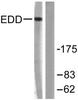 UBR5 Polyclonal Antibody