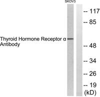 TRα Polyclonal Antibody