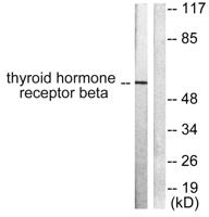 TRβ1 Polyclonal Antibody