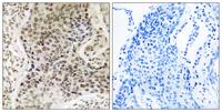 TSEN54 Polyclonal Antibody