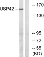 USP42 Polyclonal Antibody