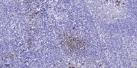 UTRO Polyclonal Antibody