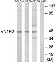 V1RL2 Polyclonal Antibody