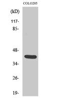 Vasohibin Polyclonal Antibody