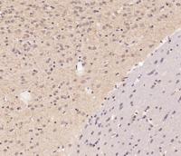 Vasohibin Polyclonal Antibody