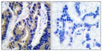 VASP Polyclonal Antibody