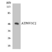 V-ATPase C2 Polyclonal Antibody