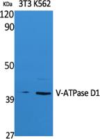 V-ATPase D1 Polyclonal Antibody