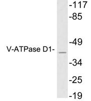 V-ATPase D1 Polyclonal Antibody