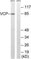 VCP Polyclonal Antibody