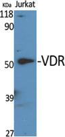 VDR Polyclonal Antibody