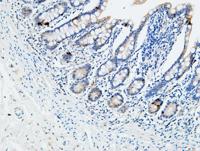 VDR Polyclonal Antibody