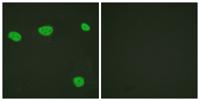 VDR Polyclonal Antibody