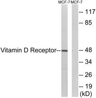 VDR Polyclonal Antibody