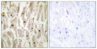 TSHZ1 Polyclonal Antibody