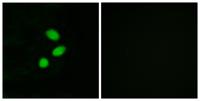 TSHZ2 Polyclonal Antibody