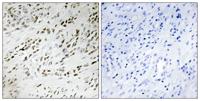 TSHZ2 Polyclonal Antibody