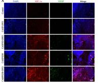 VEGF-A Polyclonal Antibody