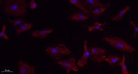 VEGF-A Polyclonal Antibody