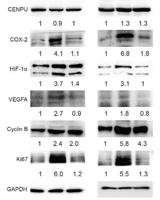 VEGF-A Polyclonal Antibody