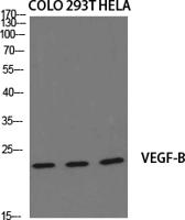 VEGF-B Polyclonal Antibody