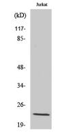 VEGF-B Polyclonal Antibody