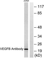 VEGF-B Polyclonal Antibody