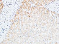 VEGF-C Polyclonal Antibody