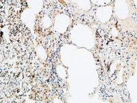 VEGF-D Polyclonal Antibody