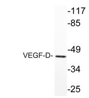 VEGF-D Polyclonal Antibody