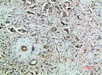 Flk-1/VEGFR2 Polyclonal Antibody